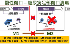 「高血糖障礙」卡在發炎期，糖尿病足潰瘍易截肢！醫：平衡微環境幫助快速癒合