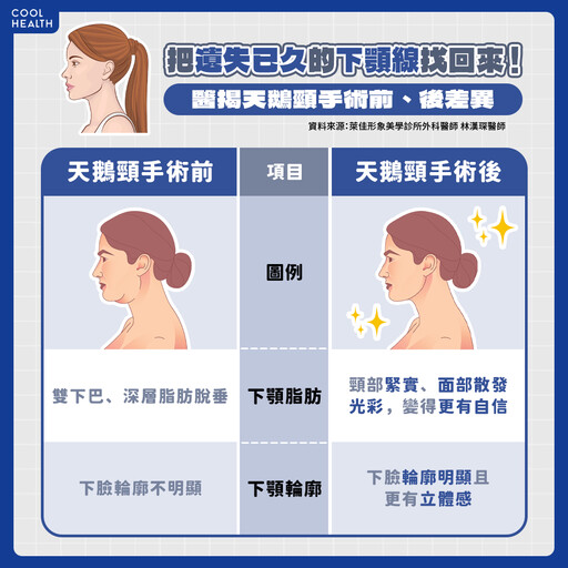 雙下巴怎麼瘦最快？ 每天運動根本沒用？ 「2方法」輕鬆找回下顎線