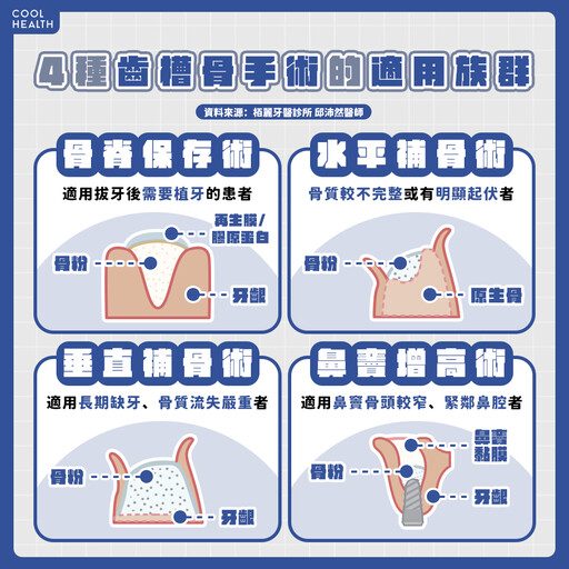 口腔環境的「地基主」！拔牙後必知「齒槽骨保存術」