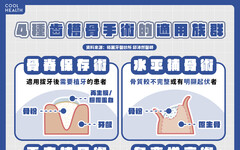 口腔環境的「地基主」！拔牙後必知「齒槽骨保存術」