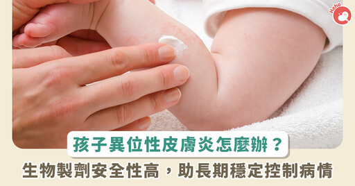 幼兒異膚治療擔心傷肝、有害生長!醫解答「類固醇、免疫調節劑」安全嗎?