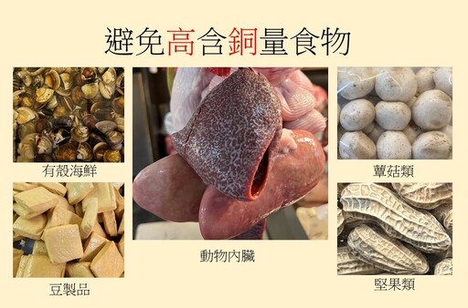 別以為是單純肝病!「威爾森氏症」四成患者出現像肝炎表現