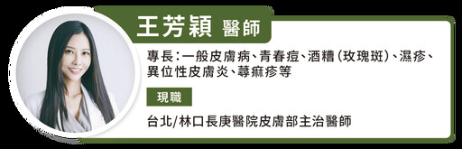 9 歲就長痘，青春痘竟與體質有關！皮膚科醫師建議：青春痘能根治 3 關鍵很重要