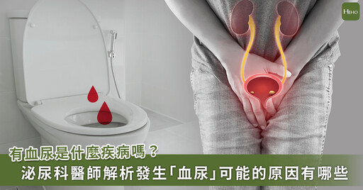 出現「血尿」可能是哪些疾病?不會痛的血尿更要注意