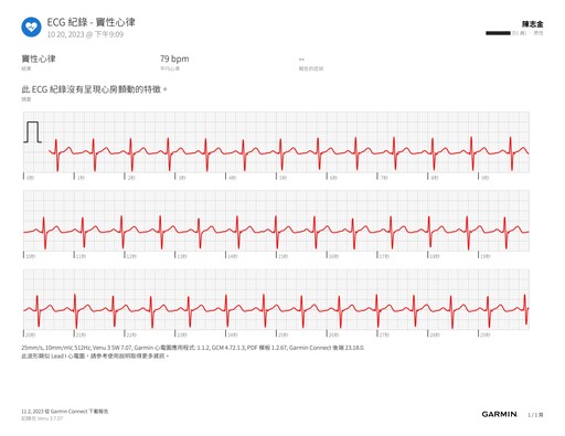 心血管疾病不只因肥胖 睡眠障礙造成多重影響！專家：智慧手錶日常紀錄幫助自我健康管理