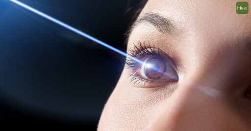 近視雷射讓眼睛乾澀？眼科權威詳解術前、術後怎麼避免「乾眼症」