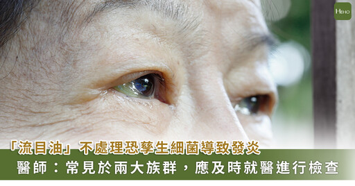 上了年紀流眼油,當心變蜂窩性組織炎!一次看懂「鼻淚管阻塞」治療方式