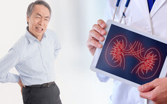 「腰痛」常見有三大原因！該怎麼與辨別是否為腎臟發炎？