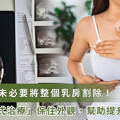 乳癌未必都要切掉乳房！醫師靠「前導式治療」保住外觀