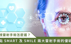 近視雷射不掀瓣手術成趨勢！SMART transPRK 和 SMILE 該選哪一個？台中專業眼科醫師分析優劣