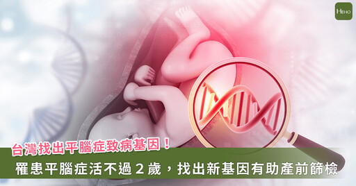 「平腦症」活不過2歲！台灣找到致病基因，有助加速診斷與產前檢查