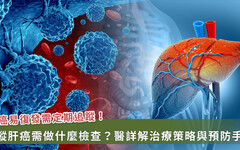 7旬翁晚期肝癌頻復發！醫：對抗癌症復發用「1」方法可保命