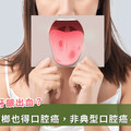反覆口腔潰瘍可能是口腔癌？醫提醒：出現這「4種」情況要小心