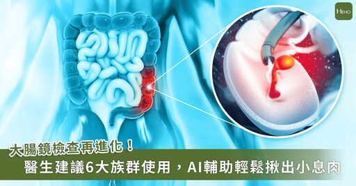 大腸鏡檢查再進化，AI 助攻揪出小息肉！醫建議 6 族群採用
