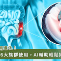 大腸鏡檢查再進化，AI 助攻揪出小息肉！醫建議 6 族群採用