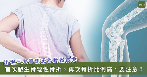 女性更容易骨質疏鬆!出現 3 警訊:身高變矮 4 公分小心 健保擴大用藥給付