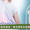 女性更容易骨質疏鬆！出現 3 警訊：身高變矮 4 公分小心 健保擴大用藥給付