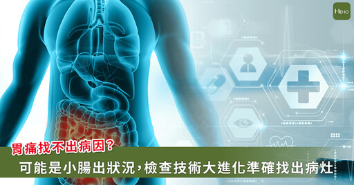 胃痛一直好不了?可能是胃鏡照不到的小腸出問題!