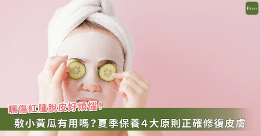 曬傷敷蘆薈、小黃瓜、蛋白恐讓皮膚更糟?! 醫師公開夏季保養4大原則