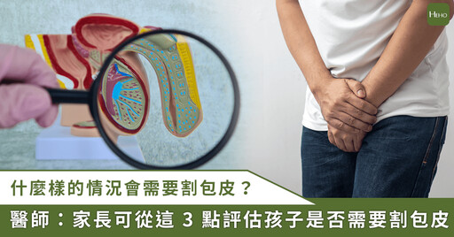 孩子該不該割包皮？醫師提醒：可從 3 點初步判斷