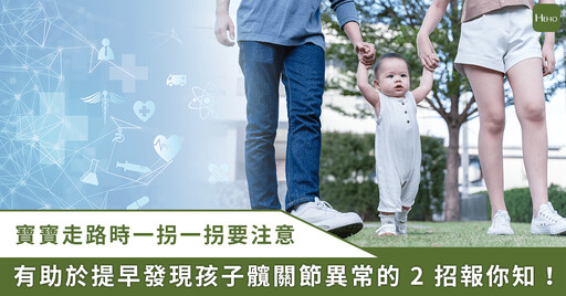 寶寶走路怪怪的？骨科醫師鄭士豪：2 招檢測髖關節發育不良徵兆，掌握黃金治療期