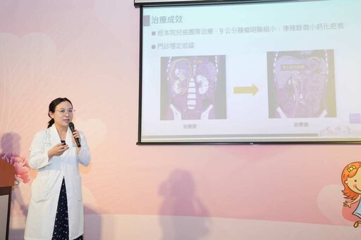 中醫大附醫精準質子治療 為孩子搶回未來