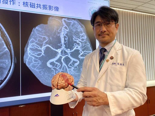 新式經靜脈血管造影術結合AR導航 台中榮總精準腦內「拆彈」救童