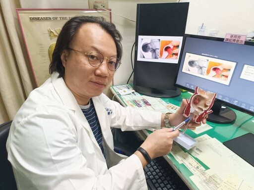 雷射痔瘡消融手術溫和又有效 開完刀就能下樓買便當