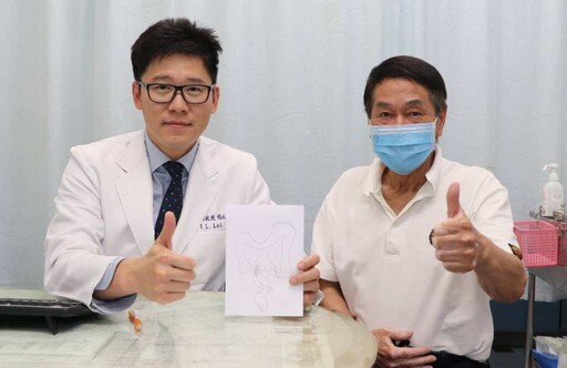 便血一年檢查揪出直腸早期腺癌 大里仁愛醫院達文西手術精準切除