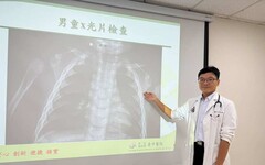 男嬰對抗「大魔王」肺炎鏈球菌 疫苗防護網助康復出院