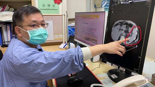影／車禍輕忽就醫延誤 男子肋骨斷四根合併脾臟破裂險喪命