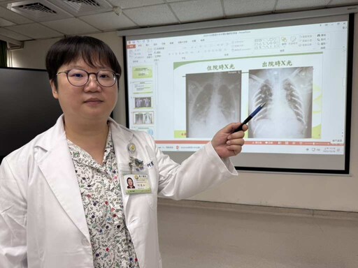 雙側肋骨遭工具車擠壓變形!14根鈦合金固定肋骨讓「鋼鐵人」重生