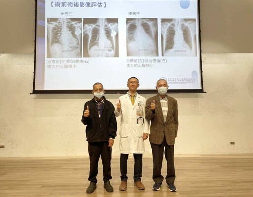 腳水腫容易喘竟是心臟瓣膜問題 中醫大市醫修補僧帽瓣手術助重拾順暢呼吸