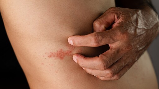 冬天乾癢不只是皮膚問題？50歲以上免疫力低，小心是這毛病？！
