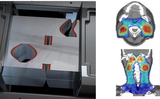 嘉基引進6D導航弧形刀 精準守護癌友健康