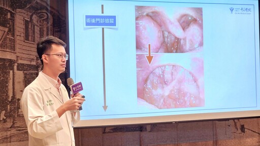 男子長期打鼾 微創鼻竇及鼻中膈鼻道成型手術 通氣