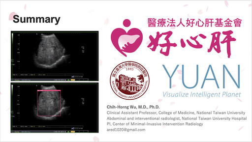 亞太肝臟學會研究者獎出爐 台灣超音波檢查AI即時偵測辨識肝腫瘤運用獲獎