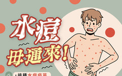 水痘毋通來！台東縣衛生局籲留意幼童衛生降低感染風險