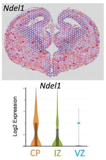 高雄長庚VS陽明交大研究團隊 再次發現「平腦症」致病新基因-NDEL1