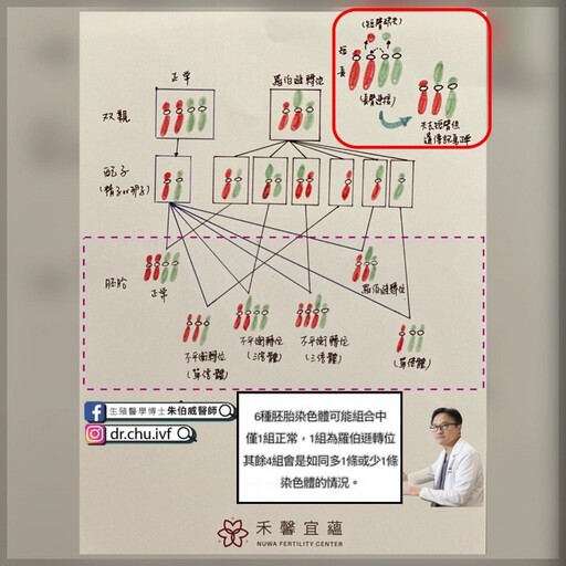 「羅伯遜轉位」藏危機：基因檢測如何改變反覆流產命運？