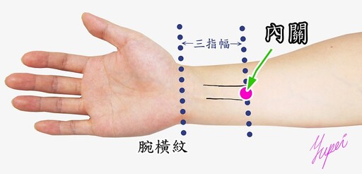 60歲罹癌婦人化療出現手腳麻木症狀 中醫調理緩解不適