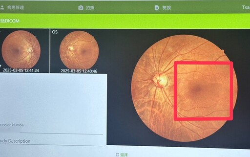 嘉榮提醒糖友每年一次眼底檢查 守護靈魂之窗