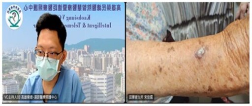 高榮X高醫、8大院所 打造原鄉健康守護網 六場全人整合照護篩檢活動圓滿成功