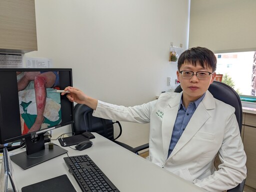 60歲男錯誤清潔釀蜂窩性組織炎！冬季皮膚乾癢紅腫勿輕忽