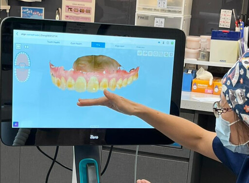 矯正必拔牙？ 醫師：注重「保齒與曲線」才能優化治療效果