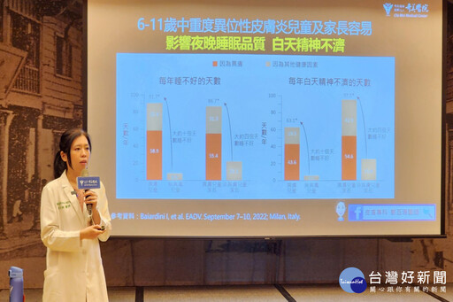 兒童異位性皮膚炎 奇美醫：生物製劑治療可緩解改善