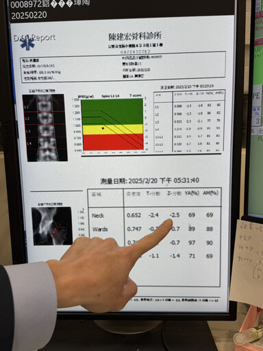 苗條女咳到肋骨骨折 骨鬆體質惹禍