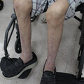 走路常跌並非骨鬆？ 75歲嬤驚見「肌少症」藏危機