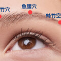 擺脫人工淚液依賴 針灸改善乾眼症困擾