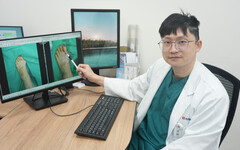 拇趾外翻不是外觀問題 醫師警告拖太久恐致連鎖變形與關節炎